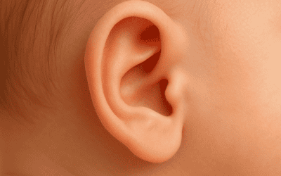 Protruding Ears and Prominent Ears Deformity: The Path from Diagnosis to Treatment