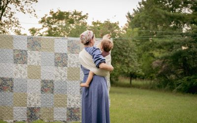 Dumbo Ears in Babies: How to Address Protruding Ears Without Surgery